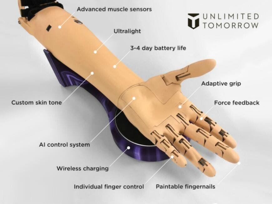 True Limb Bionic Prostheses