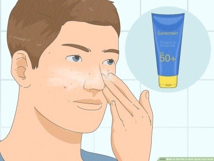 Get Rid of Acne