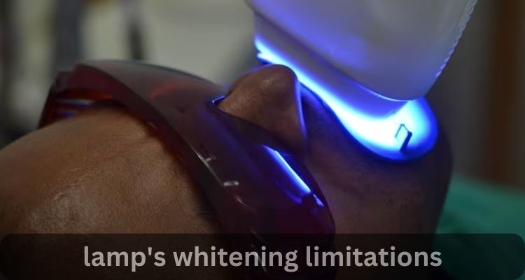 lamp's whitening limitations